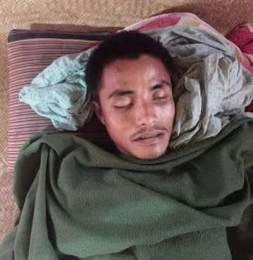 ঘরের বিদ্যুৎ লাইনে কাজ করতে গিয়ে বিদ্যুৎস্পৃষ্ঠ হয়ে বেনসন চাকমা'র  মৃত্যু