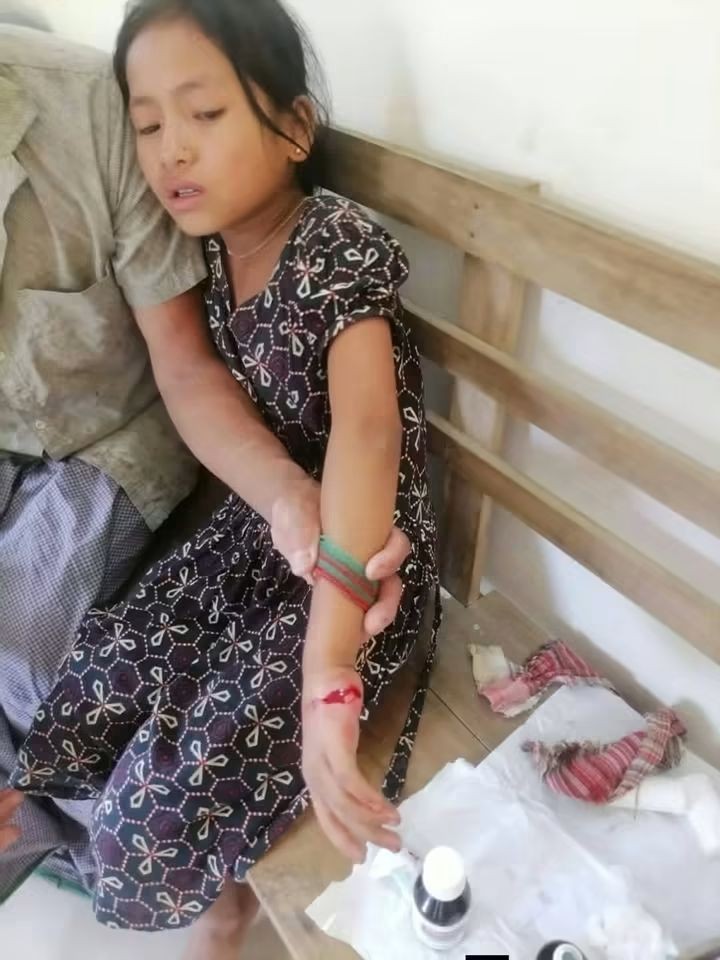 সাজেকে সংঘর্ষে শিশু গুলিবিদ্ধ, পিসিসিপির নিন্দা